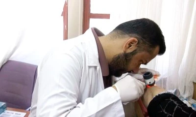 Uzmanından Uyarı: Sedef Hastalığı Bulaşıcı Değil, Tedavi Edilebiliyor